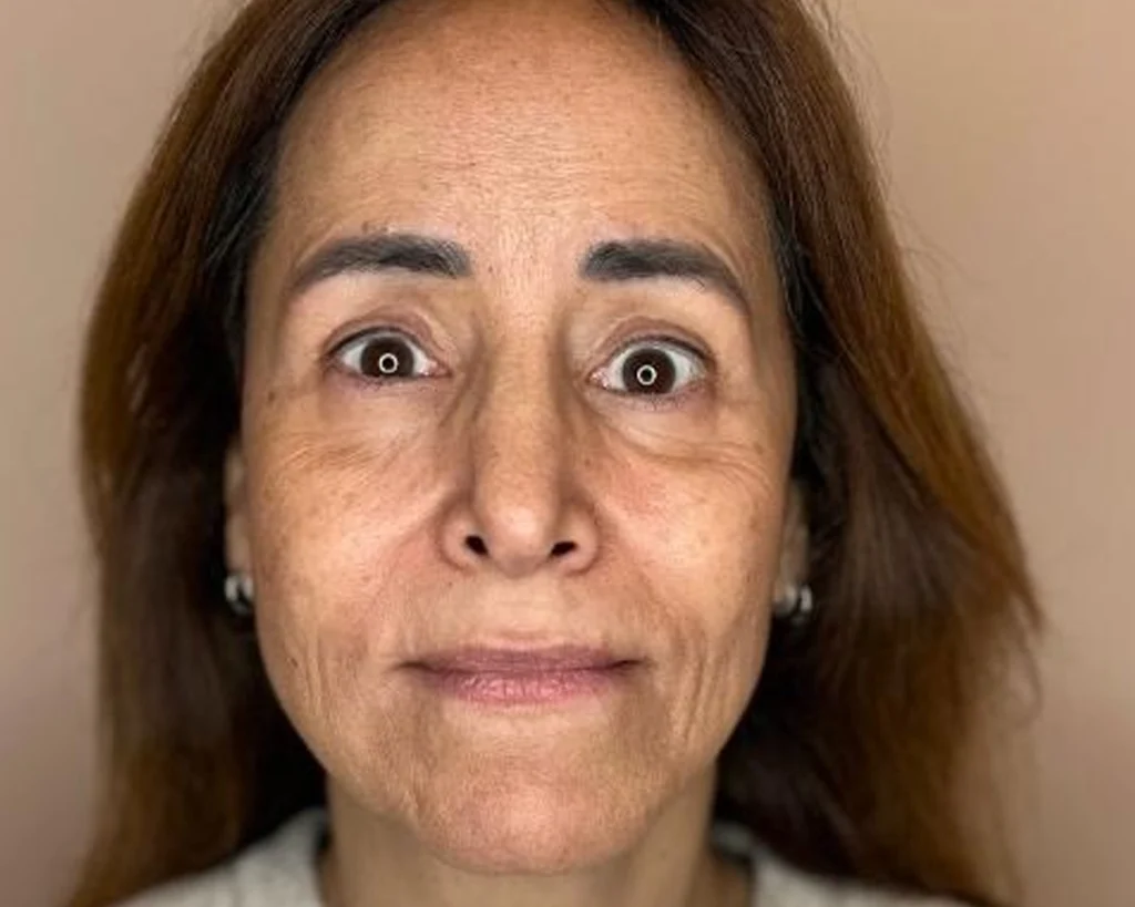 Claudia Diniz depois