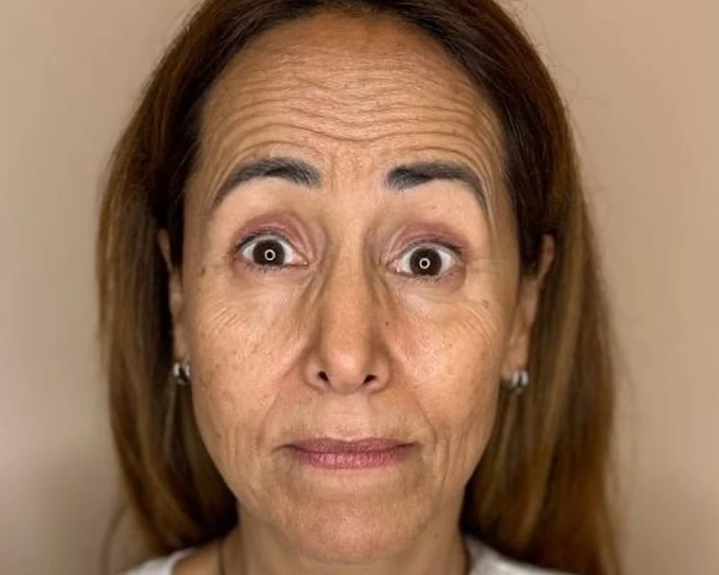 Claudia Diniz antes